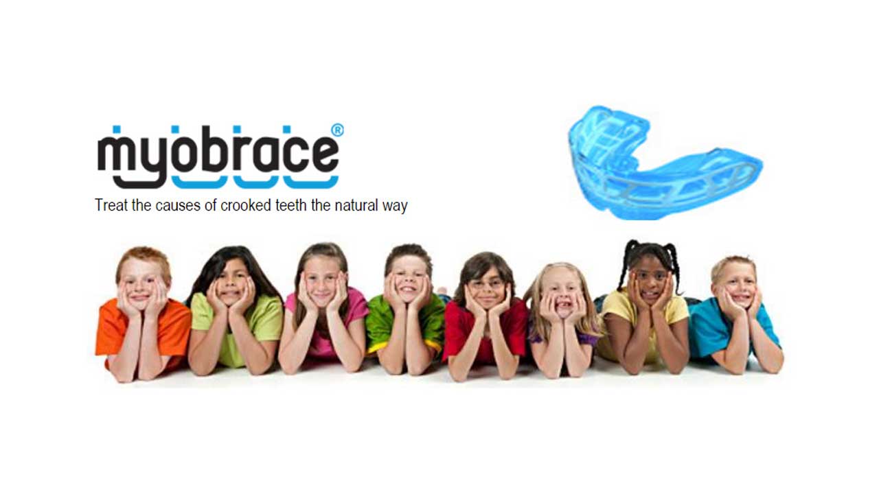 my-obrace