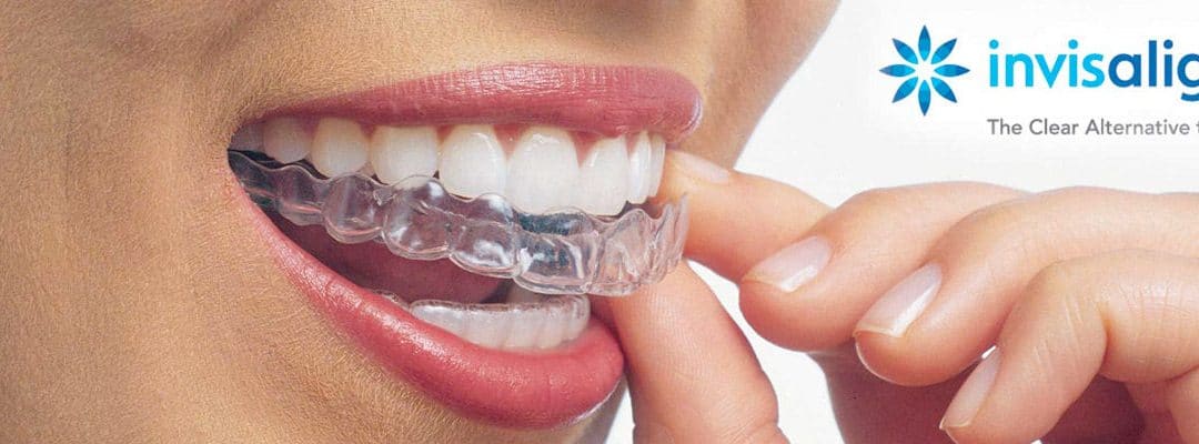 header_invisalign