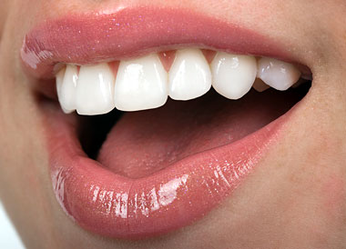 Everything You Need To Know About Porcelain Veneers