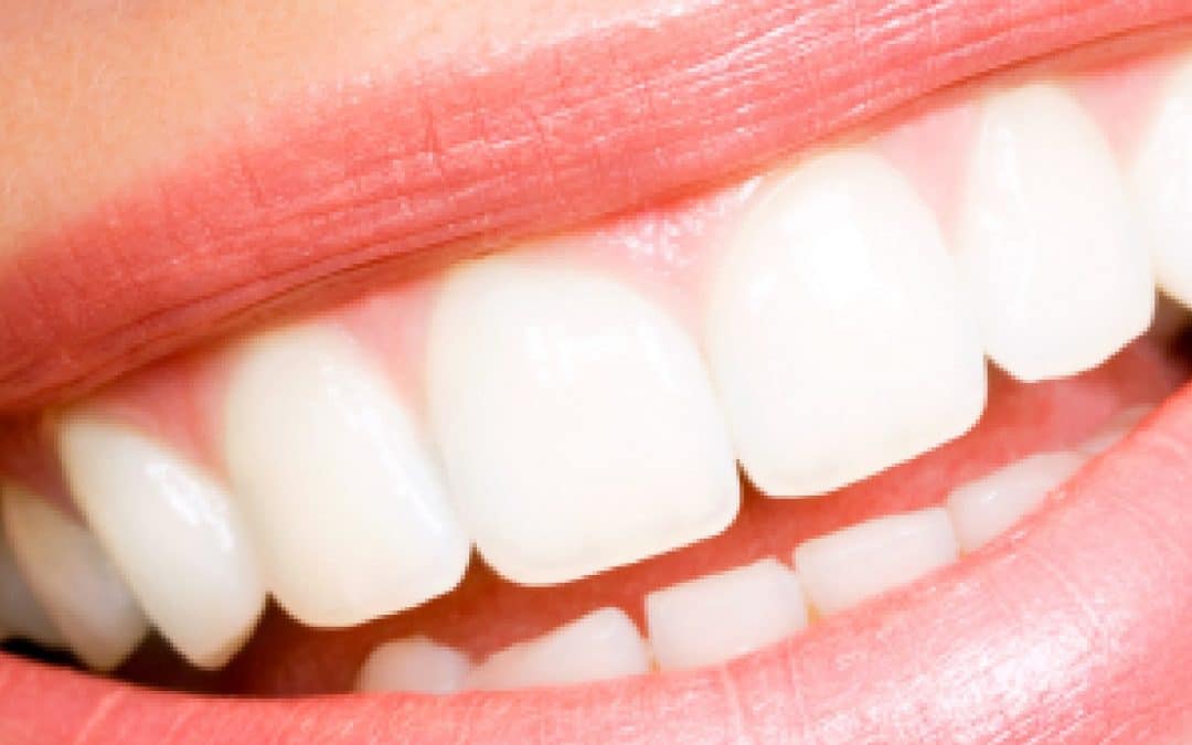 Cosmetic Dentistry