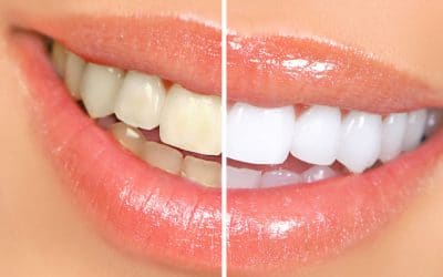 Cosmetic-Dentistry-Home-Page