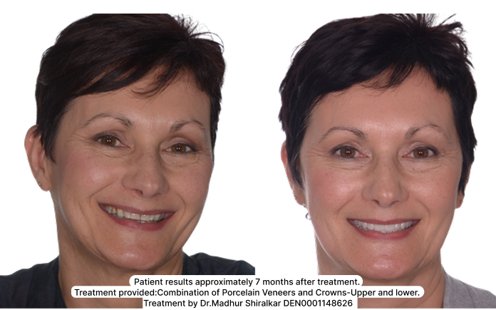 Not Just a New Smile. A Healthier One