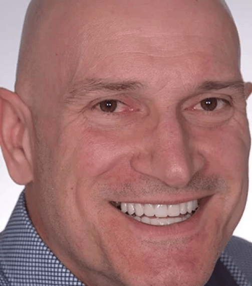 We Transform Your Smile