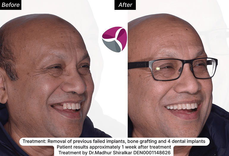 Which Treatment Do You Need Which Treatment Do You Need