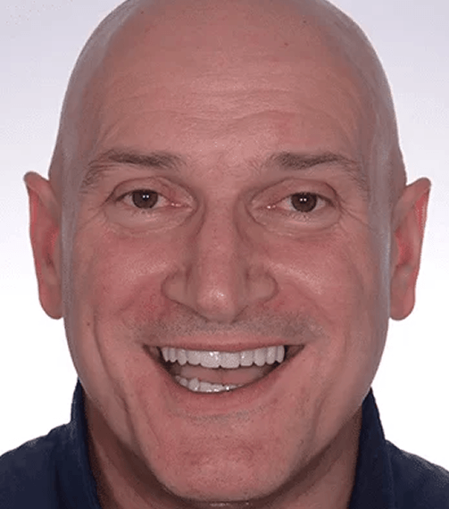 We Create “The Trial Smile”